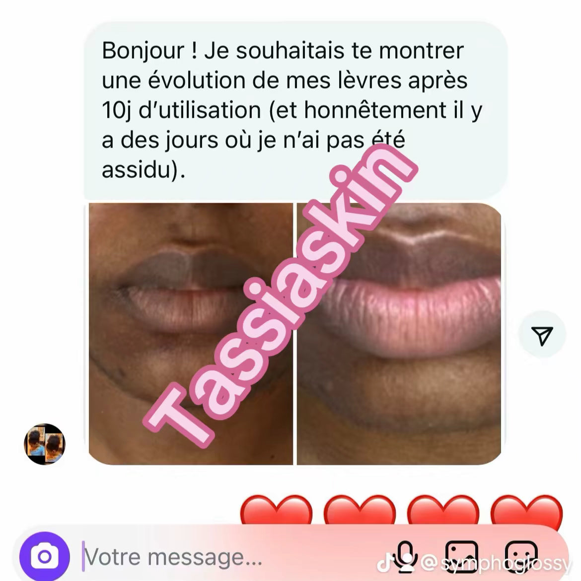 Baume lèvres roses 👄