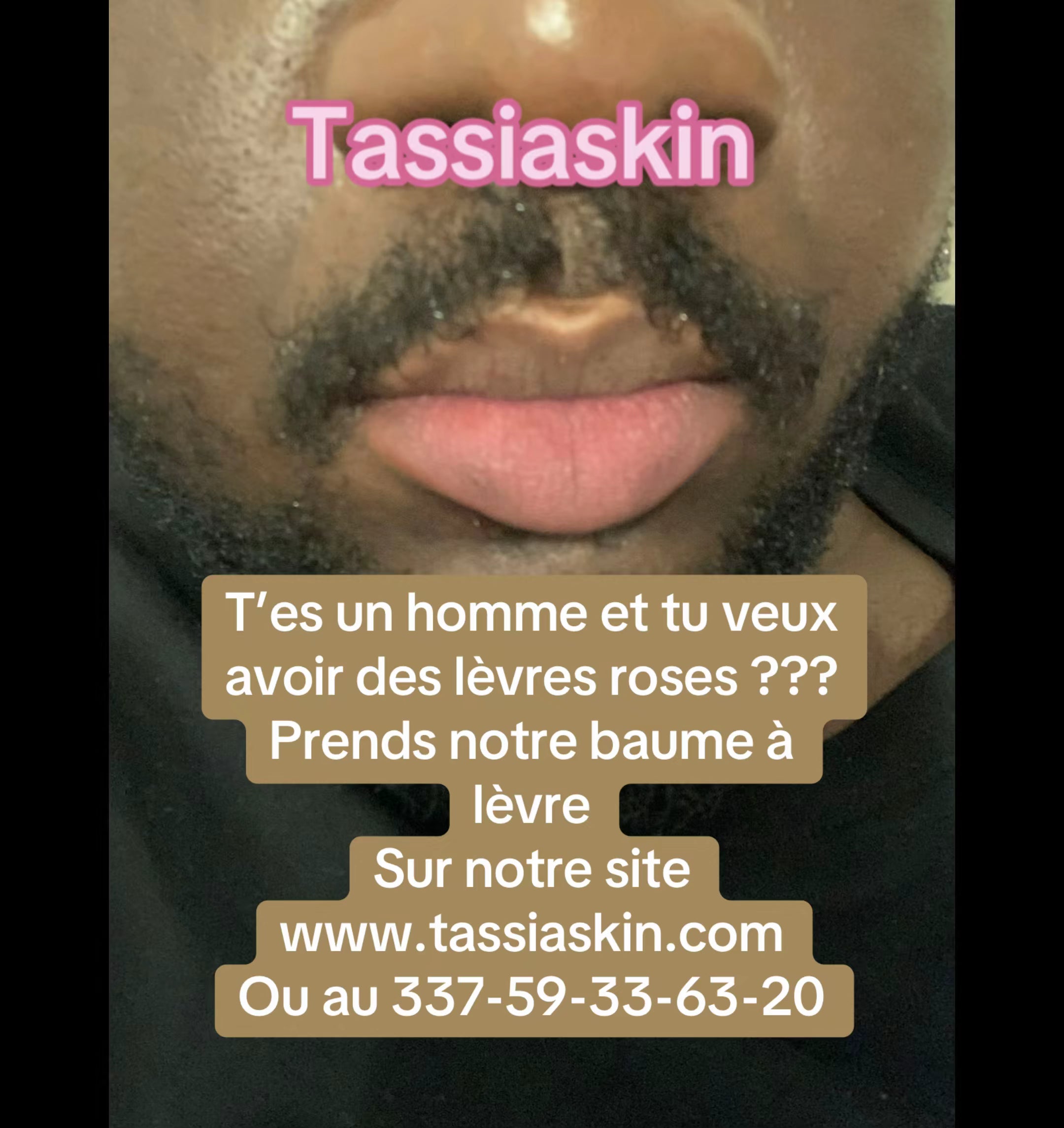 Baume lèvres roses