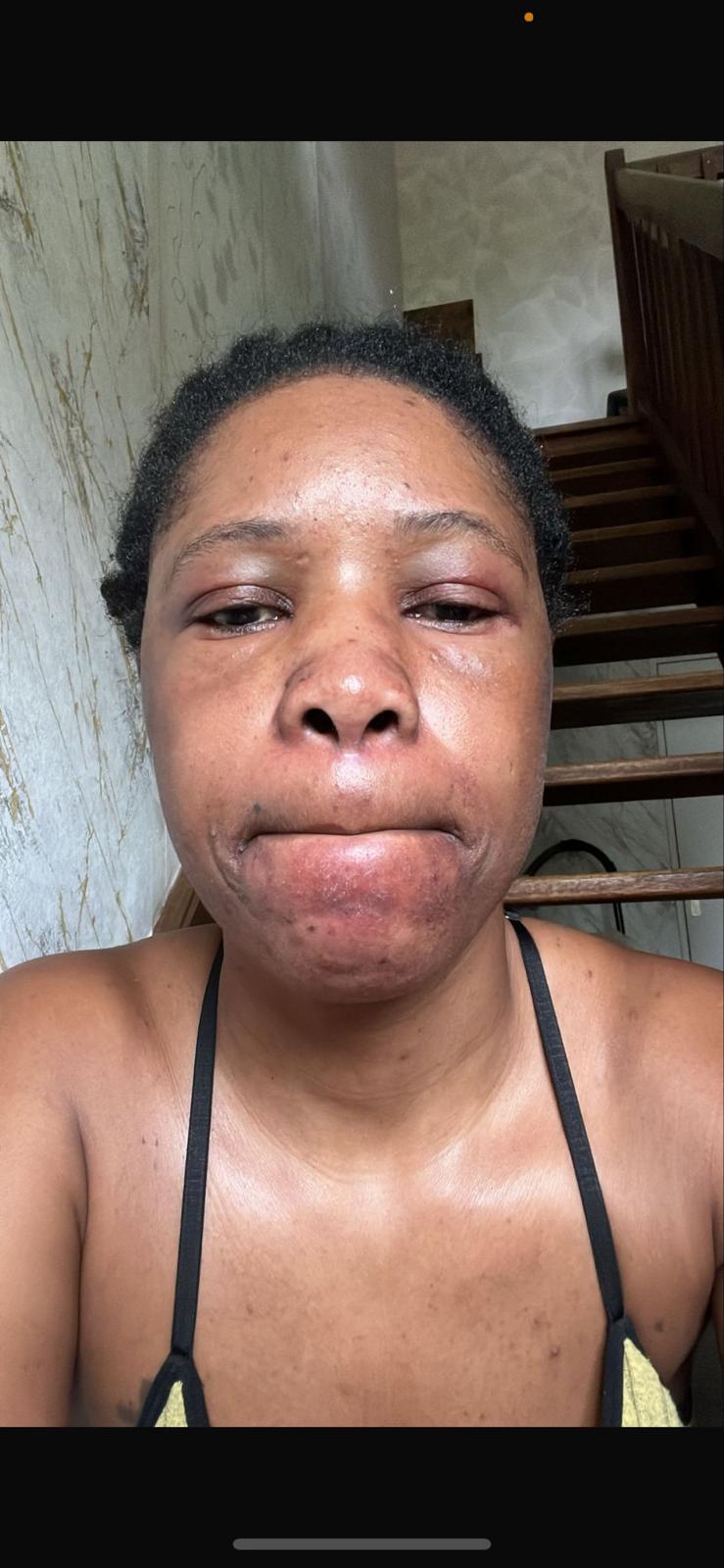 Sérum au curcuma anti tache